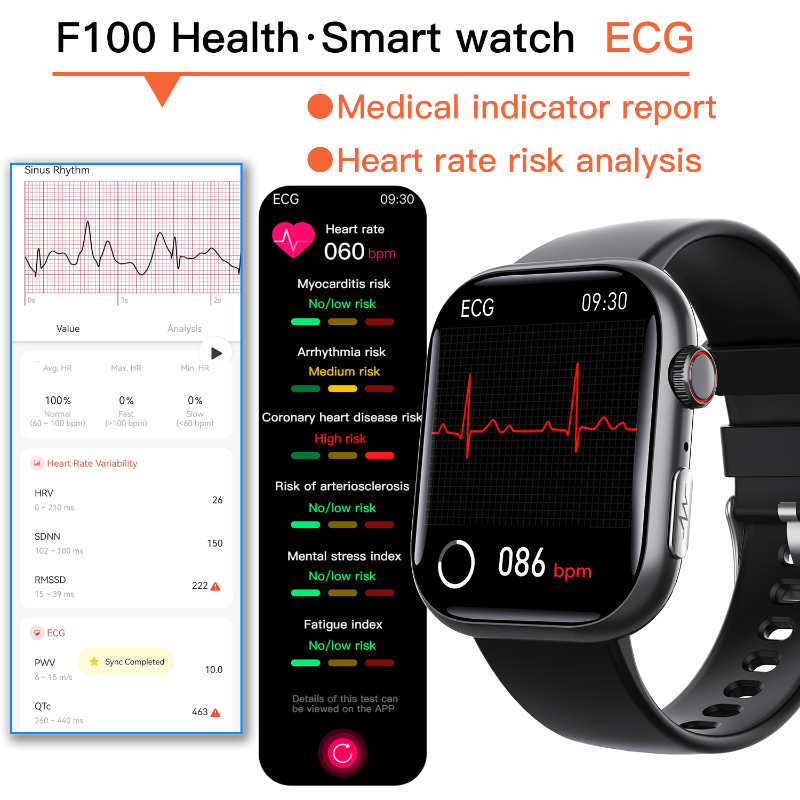 Best ECG Smart Watch of 2025 With Blood Pressure Monitor+Blood Glucose Monitoring